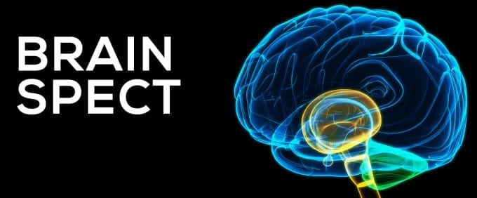 Brain SPECT